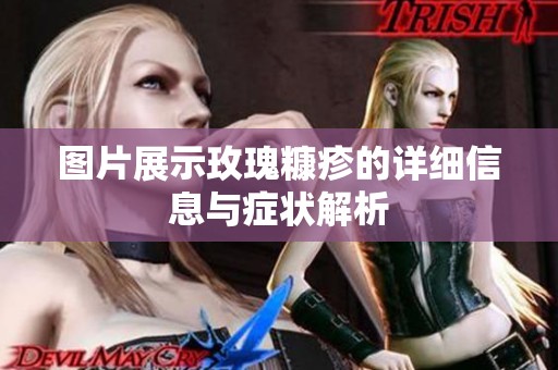 图片展示玫瑰糠疹的详细信息与症状解析