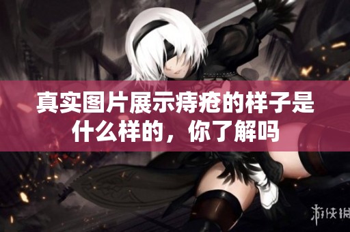 真实图片展示痔疮的样子是什么样的，你了解吗